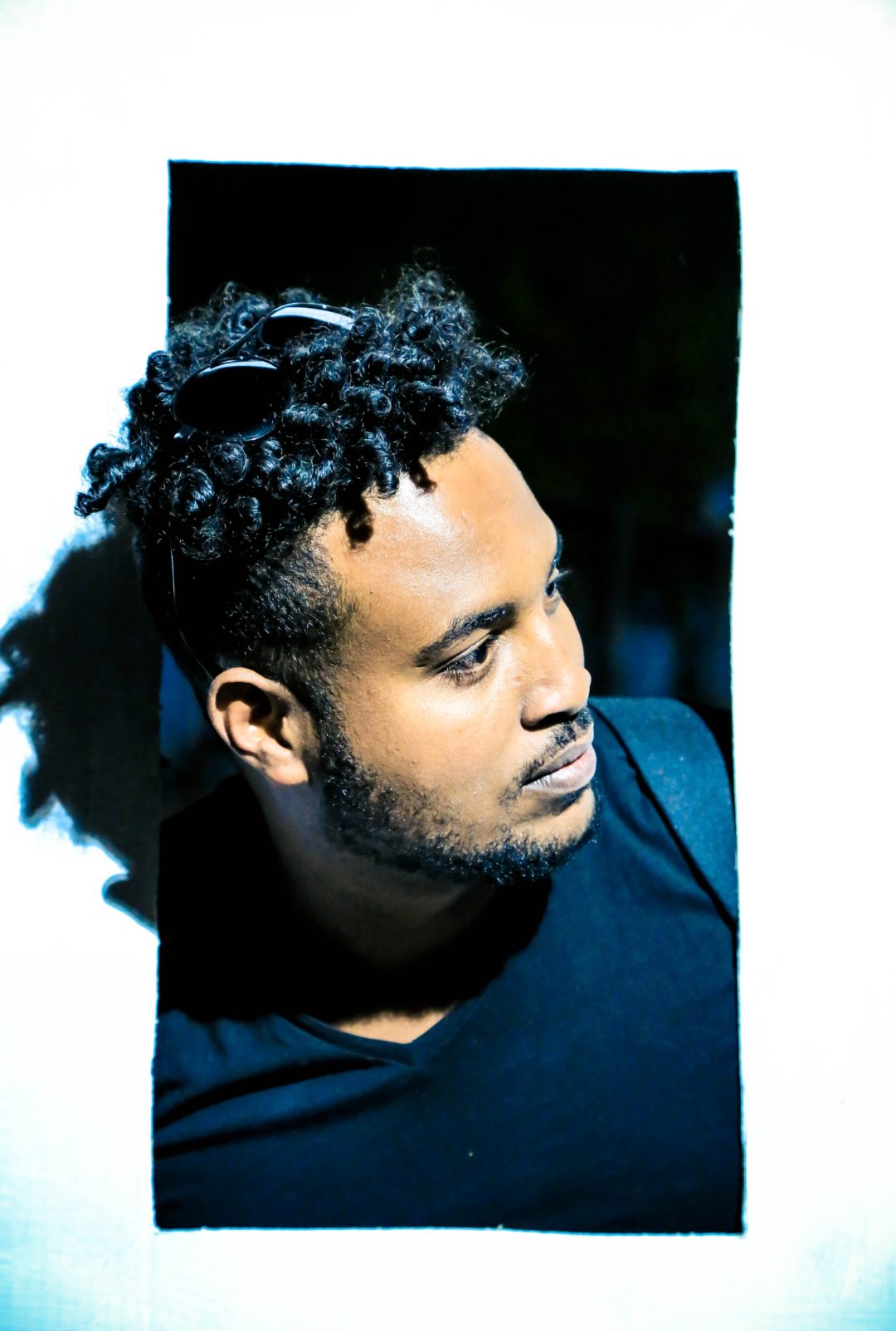 Electrolysis For Men s Facial Hair electrolysis-for-men-s-facial-hair