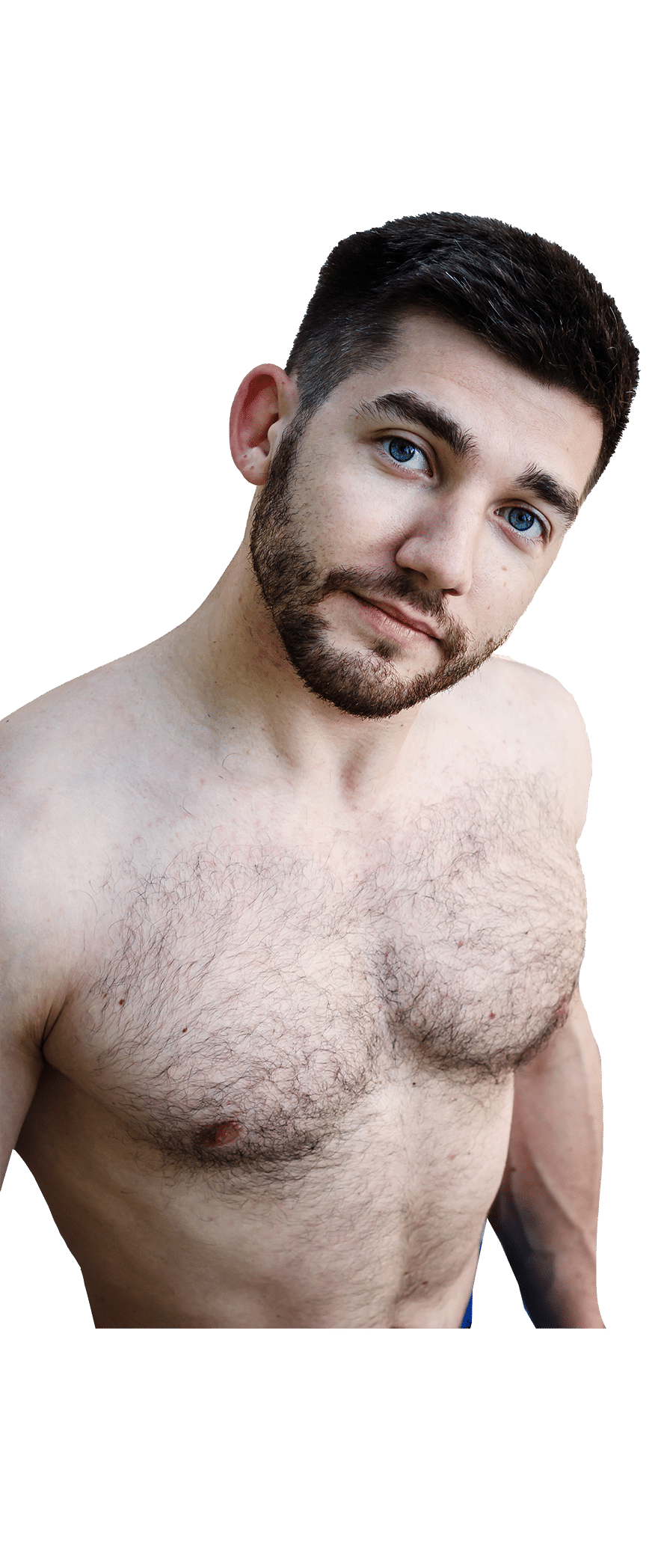 Male Body Hair Problems Electrolysis by Alison