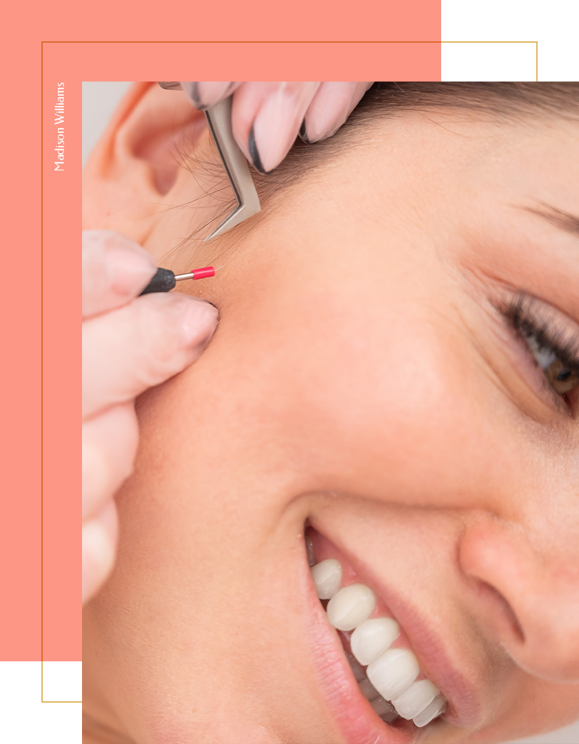 Best Electrologist and Permanent Hair Removal Expert_ Best Electrologist and Permanent Hair Removal Expert