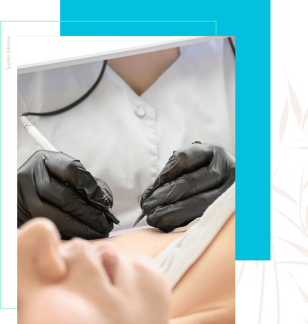 Blond Permanent Hair Removal_ Blond Permanent Hair Removal